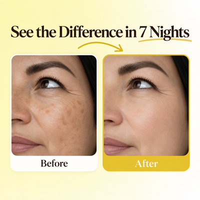 Osari Glutathione 7-Night Dark Spot Patches