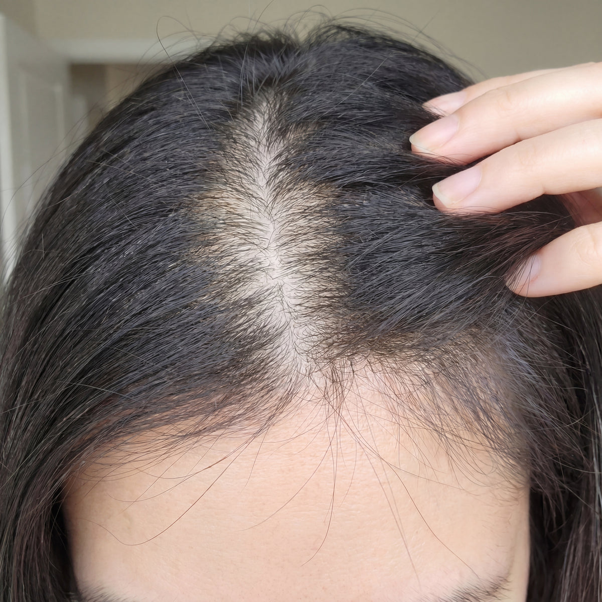 Before